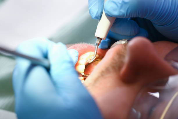 Best After-Hours Emergency Dentist in Williamsport, IN