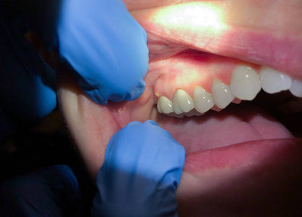 Best Pediatric Emergency Dentist in Williamsport, IN